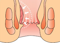 肛門のイメージ画像